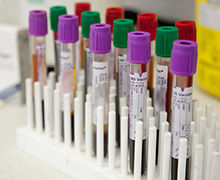 Equine blood sample