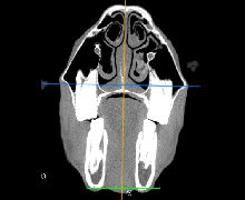 Computed Tomography (CT) for Horses